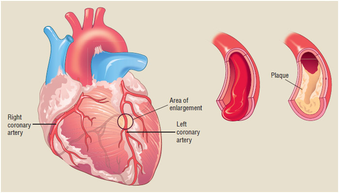 Heart Health in Varanasi: Comprehensive Cardiology Services at Infinity Care Hospital