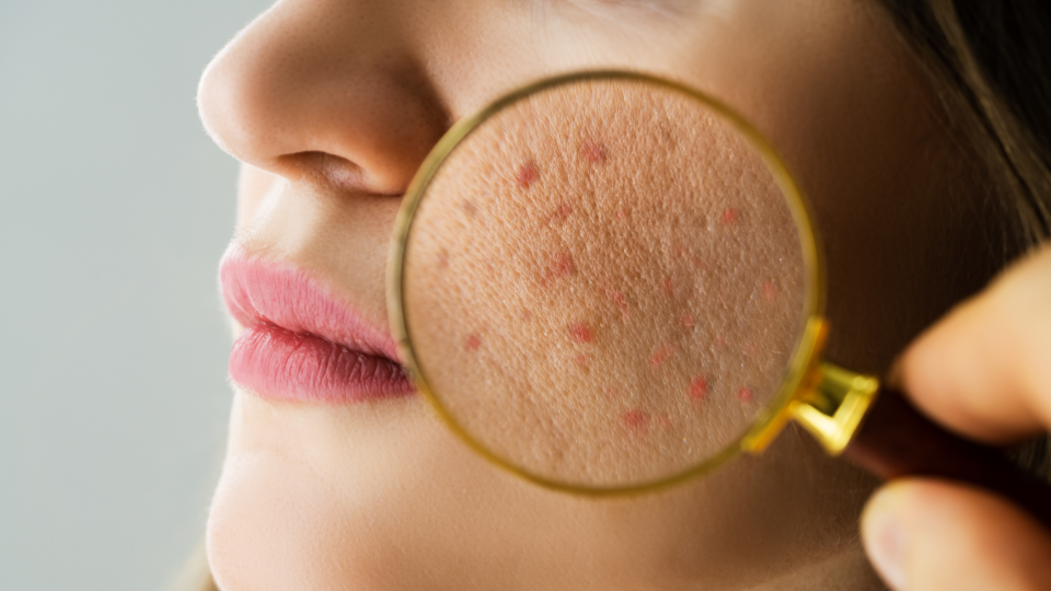 Best Dermatologist in Varanasi: Transform Your Skin at Infinity Care Hospital