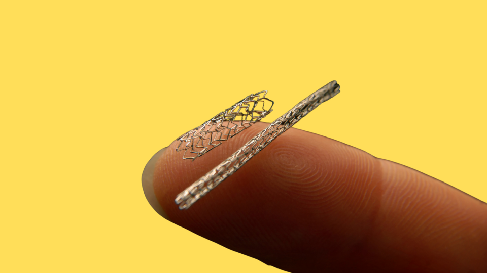 Heart Stents Guide : Procedure, Duration & Longevity Explained for Indians