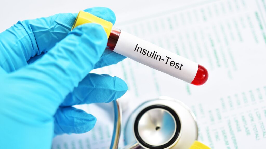 What is Insulin Resistance: A Comprehensive Guide for Indians
